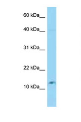 GOLGA7B / C10orf132 antibody LS-C146215 Western blot of 3 Cell lysate. Antibody concentration 1 ug/ml.