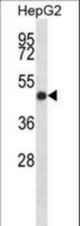 IHH Antibody western blot of HepG2 cell line lysates (35 ug/lane). The IHH antibody detected the IHH protein (arrow).