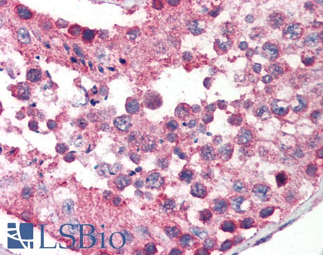 Anti-IKBKAP / IKAP antibody IHC of human testis. Immunohistochemistry of formalin-fixed, paraffin-embedded tissue after heat-induced antigen retrieval. Antibody LS-B571 concentration 5 ug/ml.