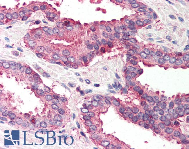 Anti-IKBKAP / IKAP antibody IHC of human prostate. Immunohistochemistry of formalin-fixed, paraffin-embedded tissue after heat-induced antigen retrieval. Antibody LS-B571 concentration 5 ug/ml.
