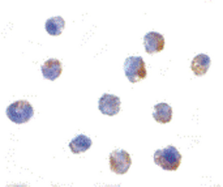 Immunocytochemistry of IKAP in A-20 cells with IKAP antibody at 1 ug/ml.