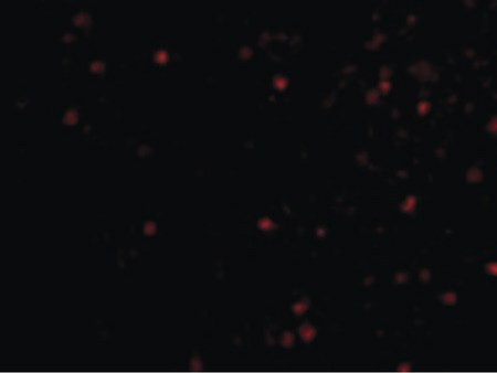 Immunofluorescence of IKAP in A20 cells with IKAP antibody at 20 ug/ml.