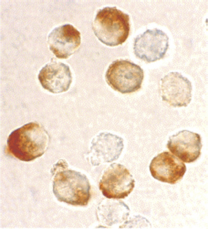 Immunocytochemistry staining of HeLa cells using IKK beta antibody at 10 ug/ml.