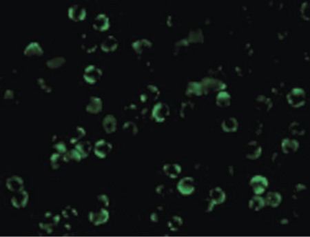 Immunofluorescence of IKK beta in HeLa cells with IKK beta antibody at 10 ug/ml.