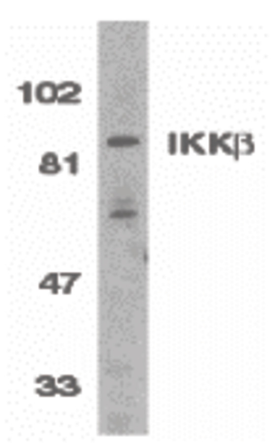 Western blot of IKK beta in Jurkat whole cell lysate with IKK beta antibody (C3) at 1:500 dilution.
