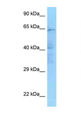 IKBKE antibody LS-C146309 Western blot of HeLa Cell lysate. Antibody concentration 1 ug/ml.