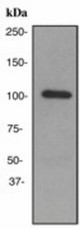 Western blot analysis on fetal skeletal muscle lysate using anti-GPR49 antibody (LS-C105455), dilution 1:1000.