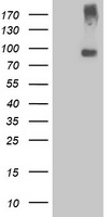HEK293T cells were transfected with the pCMV6-ENTRY control (Left lane) or pCMV6-ENTRY LGR5 (Right lane) cDNA for 48 hrs and lysed. Equivalent amounts of cell lysates (5 ug per lane) were separated by SDS-PAGE and immunoblotted with anti-LGR5.