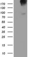 HEK293T cells were transfected with the pCMV6-ENTRY control (Left lane) or pCMV6-ENTRY LGR5 (Right lane) cDNA for 48 hrs and lysed. Equivalent amounts of cell lysates (5 ug per lane) were separated by SDS-PAGE and immunoblotted with anti-LGR5.