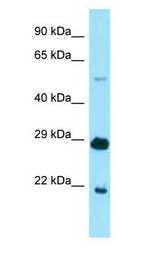 IKZF1 / IKAROS antibody Western Blot of Mouse Heart.