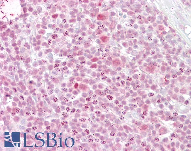 Anti-IKZF1 antibody IHC of human tonsil. Immunohistochemistry of formalin-fixed, paraffin-embedded tissue after heat-induced antigen retrieval. Antibody LS-B6493 concentration 2.5 ug/ml.