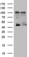 HEK293T cells were transfected with the pCMV6-ENTRY control (Left lane) or pCMV6-ENTRY LGR5 (Right lane) cDNA for 48 hrs and lysed. Equivalent amounts of cell lysates (5 ug per lane) were separated by SDS-PAGE and immunoblotted with Rabbit polyclonal anti-LGR5 antibody at 1:500 dilution.