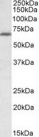 IKZF1 antibody (1 ug/ml) staining of MOLT4 lysate (35 ug protein/ml in RIPA buffer). Primary incubation was 1 hour. Detected by chemiluminescence.