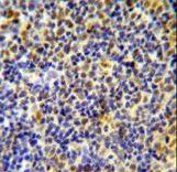 IKZF1 Antibody immunohistochemistry of formalin-fixed and paraffin-embedded human tonsil tissue followed by peroxidase-conjugated secondary antibody and DAB staining.