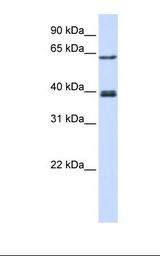Transfected 293T cell lysate. Antibody concentration: 1.0 ug/ml. Gel concentration: 12%.