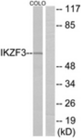 Western blot of extracts from COLO cells, using IKZF3 Antibody. The lane on the right is treated with the synthesized peptide.
