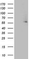 HEK293T cells were transfected with the pCMV6-ENTRY control (Left lane) or pCMV6-ENTRY IKZF3 (Right lane) cDNA for 48 hrs and lysed. Equivalent amounts of cell lysates (5 ug per lane) were separated by SDS-PAGE and immunoblotted with anti-IKZF3.