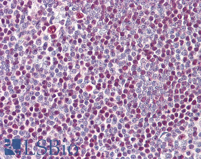Anti-IKZF3 / AIOLOS antibody IHC of human tonsil. Immunohistochemistry of formalin-fixed, paraffin-embedded tissue after heat-induced antigen retrieval. Antibody LS-B8074 dilution 5-10 ug/ml.