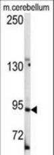 Western blot of anti-LGR5/GPR49 Antibody (loop2) in mouse cerebellum tissue lysates (35 ug/lane). LGR5/GPR49(arrow) was detected using the purified antibody.