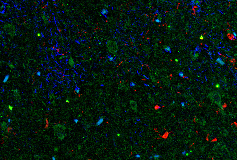 IHC of IL-11 antibody LS-C104366