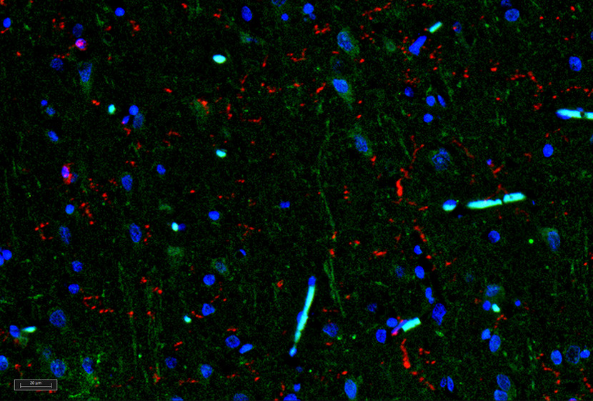 IHC of IL-11 antibody LS-C104441