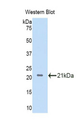 Western blot of recombinant IL11RA.