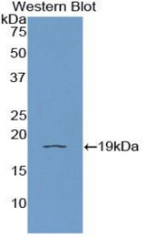 Western blot of recombinant IL11RA.