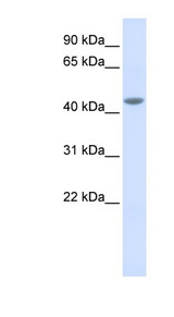 IL11RA antibody LS-C102230 Western blot of Fetal Muscle lysate.