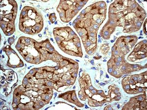 IHC of paraffin-embedded human kidney tissue using anti-IL-11R alpha antibody.