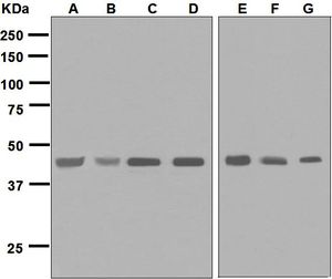 Western blot analysis on (A) 293T, (B) Saos-2, (C) A673, (D) PC-3, (E) HuT-78, (F) K562, and (G) TF-1 cell lysates using anti-IL-11R alpha antibody.