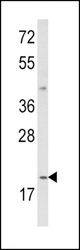 Western blot of IL12A Antibody in MDA-MB231 cell line lysates (35 ug/lane). IL12A (arrow) was detected using the purified antibody.
