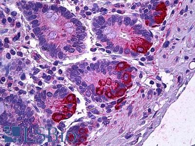 Anti-IL-12A antibody IHC of human intestine, Paneth cells. Immunohistochemistry of formalin-fixed, paraffin-embedded tissue after heat-induced antigen retrieval. Antibody LS-B6135 concentration 3.75 ug/ml.