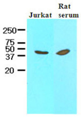 Cell lysates of Jurkat and rat serum (40 ug) were resolved by SDS-PAGE, transferred to NC membrane and probed with anti-human IL12B (1:1000). Proteins were visualized using a goat anti-mouse secondary antibody conjugated to HRP and an ECL detection system.
