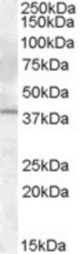 Antibody (1 ug/ml) staining of Rat Liver lysate (35 ug protein in RIPA buffer). Primary incubation was 1 hour. Detected by chemiluminescence.