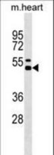 Mouse Il12b Antibody western blot of mouse heart tissue lysates (35 ug/lane). The Il12b antibody detected the Il12b protein (arrow).