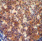 IL12B antibody immunohistochemistry of formalin-fixed and paraffin-embedded human tonsil tissue followed by peroxidase-conjugated secondary antibody and DAB staining.