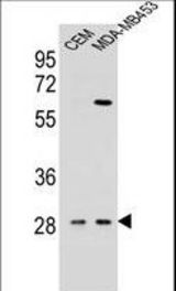 IL12B Antibody western blot of CEM,MDA-MB453 cell line lysates (35 ug/lane). The IL12B antibody detected the IL12B protein (arrow).