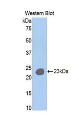 Western blot of recombinant IL12RB1 / CD212.