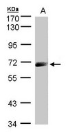 Sample (30 ug whole cell lysate). A: A431. 7.5% SDS PAGE. IL12R / CD212 antibody diluted at 1:1000