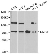 Western blot analysis of extracts of various cell lines, using IL12RB1 antibody.