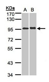 Sample (30 ug whole cell lysate). A: A431, B: Hep G2 . 7.5% SDS PAGE. IL12RB2 antibody diluted at 1:5000