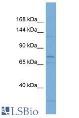 IL12RB2 antibody Western Blot of 721_B. Antibody dilution: 1 ug/ml.