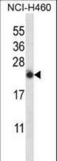 IL13 Antibody western blot of NCI-H460 cell line lysates (35 ug/lane). The IL13 antibody detected the IL13 protein (arrow).