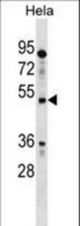 IL13RA1 Antibody western blot of HeLa cell line lysates (35 ug/lane). The IL13RA1 antibody detected the IL13RA1 protein (arrow).