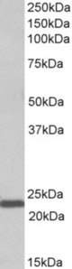 IL15 antibody (1 ug/ml) staining of Human Bone Marrow lysate (35 ug protein in RIPA buffer). Primary incubation was 1 hour. Detected by chemiluminescence.