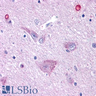 Anti-GPR50 antibody LS-A751 IHC of human brain, hypothalamus. Immunohistochemistry of formalin-fixed, paraffin-embedded tissue after heat-induced antigen retrieval.
