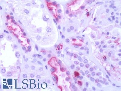 Human Kidney: Formalin-Fixed, Paraffin-Embedded (FFPE)