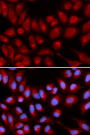 Immunofluorescence analysis of U2OS cell using IL16 antibody. Blue: DAPI for nuclear staining.