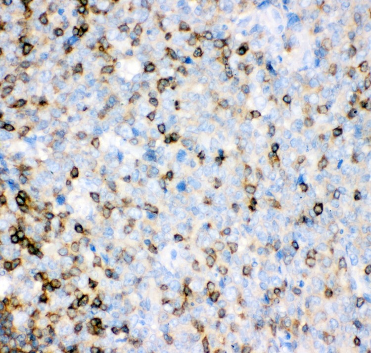IL16 antibody IHC-paraffin: Human Tonsil Tissue.