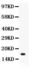 IL16 antibody Western blot. All lanes: Anti IL16 at 0.5 ug/ml. WB: Recombinant Human IL16 Protein 0.5ng. Predicted band size: 17 kD. Observed band size: 17 kD.